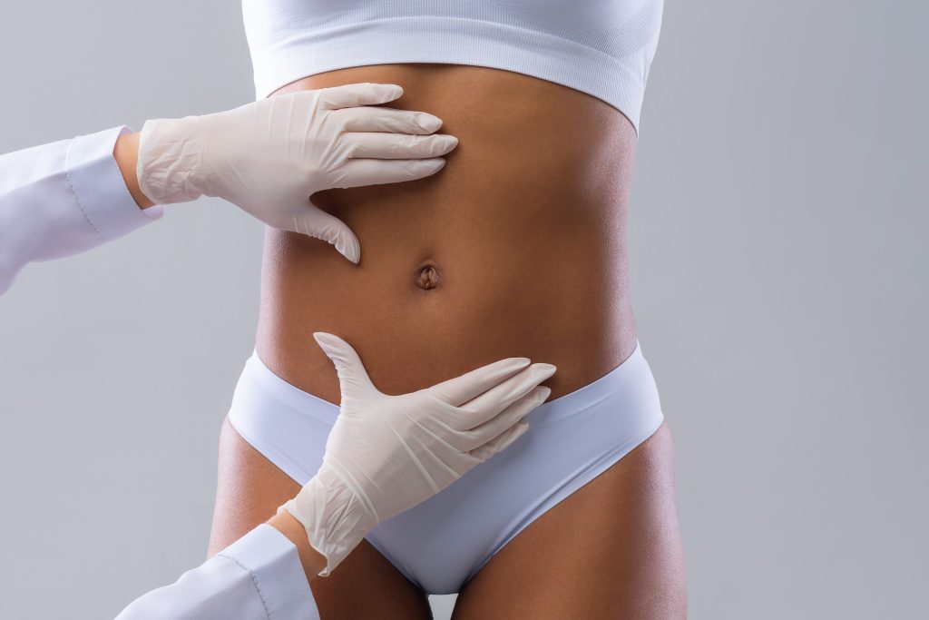 Consultation for stomach liposuction.